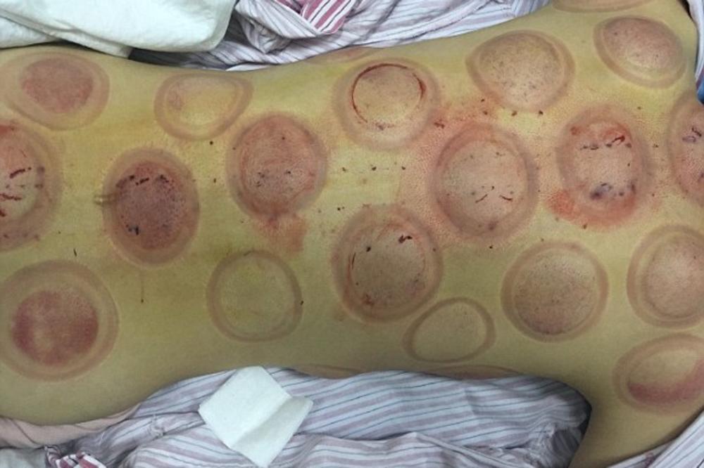 Smrt poznate glumice uzburkala javnost: Lečila rak kineskim tretmanom i umrla! (FOTO)