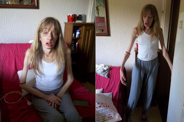 Gordana je do 11. godine bila jedna obična, zdrava devojčica. Tada kreće njen pakao, u kom je izgubila svakog! (FOTO) (VIDEO)