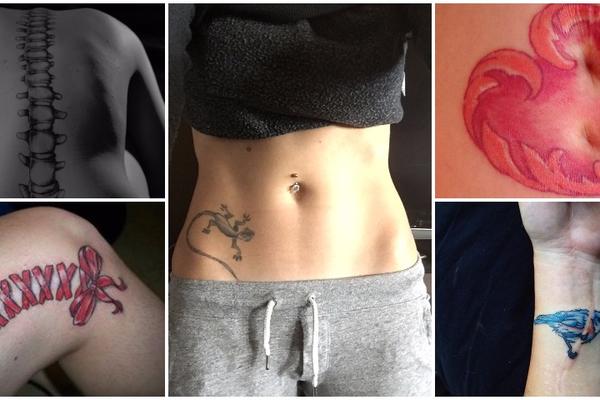 10 najlepših tetovaža koje su nastale iz ožiljka (FOTO)
