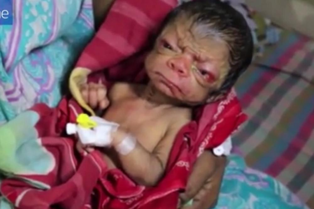 Kako je ovo moguće?! Rođena beba sa telom 80-ogodišnjeg starca! (FOTO) (VIDEO)