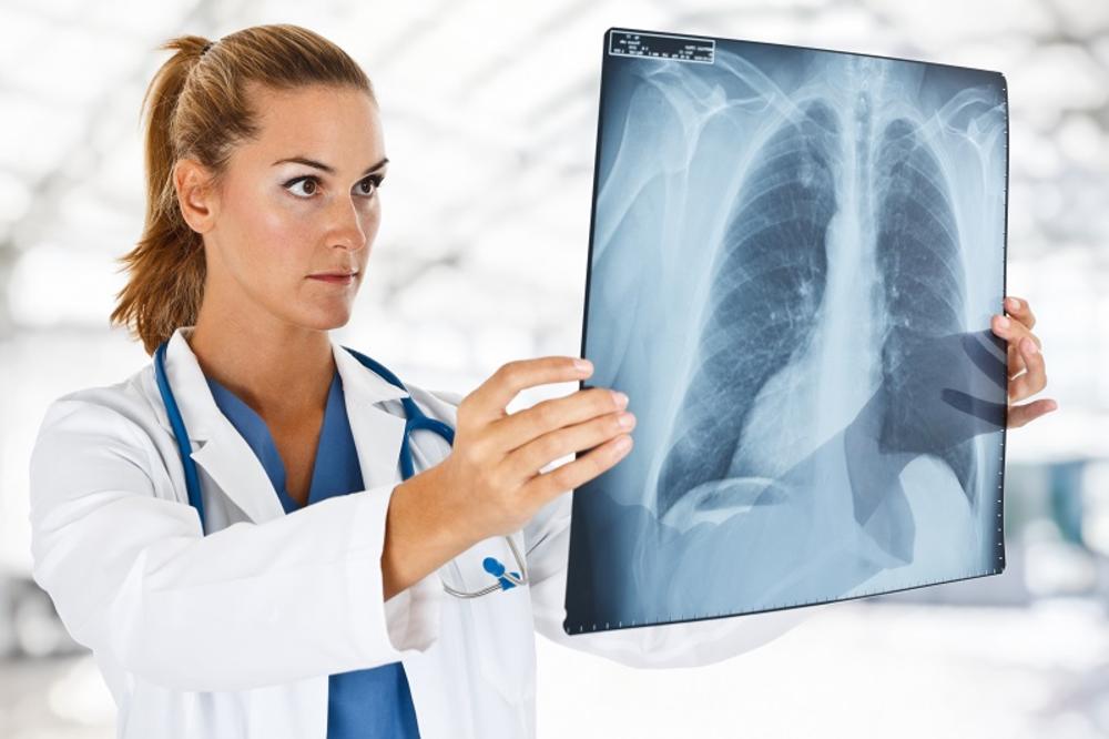 OVO SU PRVI SIMPTOMI, BUDITE VEOMA OPREZNI: Evo kada ste u opasnosti od obolevanja od raka pluća!