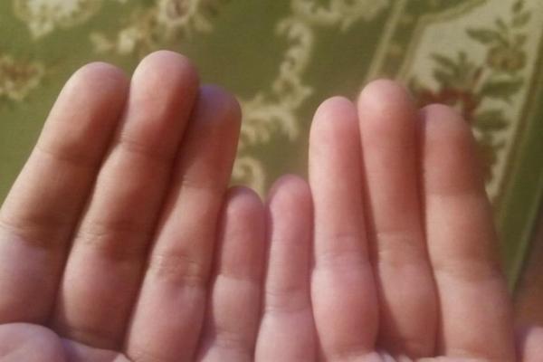 U čemu je fora s ovom fotkom? Pogledajte još jednom! (FOTO)