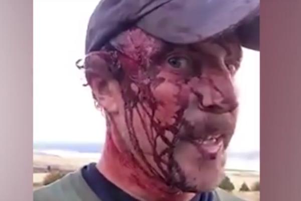 Postavio snimak na Fejs odmah nakon napada grizlija: Šokiraće vas kada vidite šta mu se desilo! (VIDEO)