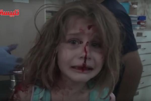 Jeziv snimak iz sirijske bolnice: Krvava devojčica izvučena iz ruševina, samo oca doziva! (UZNEMIRUJUĆI VIDEO)
