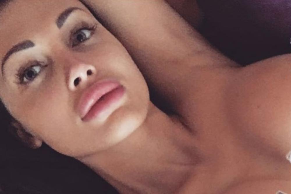 Mučenica je samo htela da bude seksi: Pokazala guzu, ali zgrozila sve silikonom u njoj! Užas! (VIDEO)