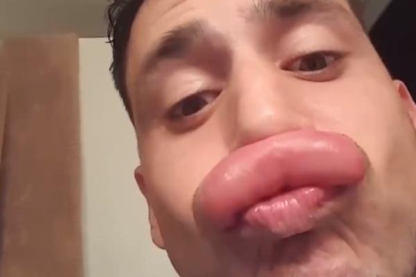 OVAKVE NEMA NI KIM KARDAŠIJAN: Frajeru, odakle ti tolike usne? (VIDEO)