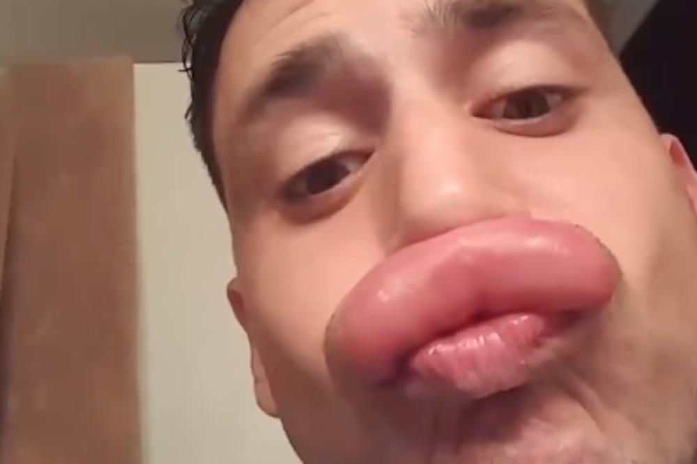 OVAKVE NEMA NI KIM KARDAŠIJAN: Frajeru, odakle ti tolike usne? (VIDEO)