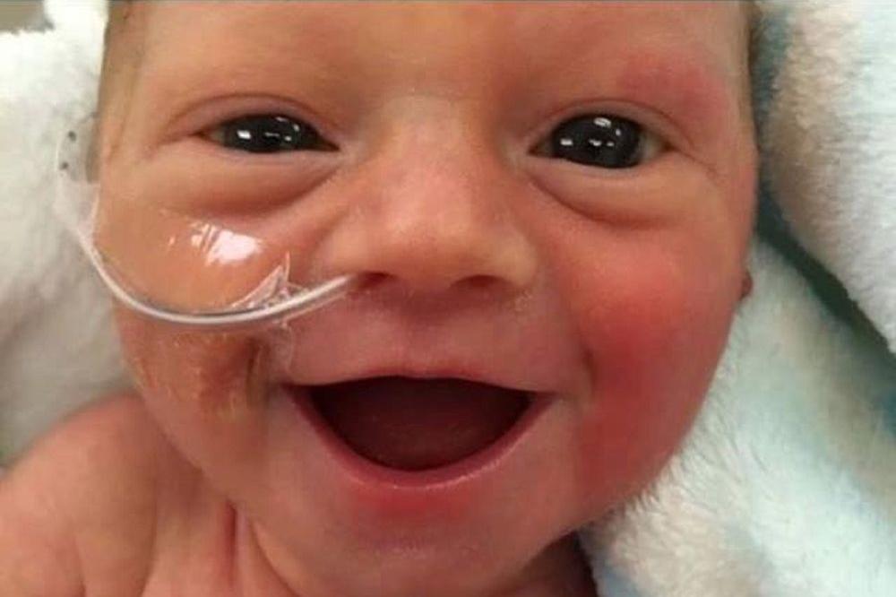 Osmeh koji je istopio svet: Ona je rođena prevremeno, ali njena priča će vam vratiti veru u život! (FOTO)
