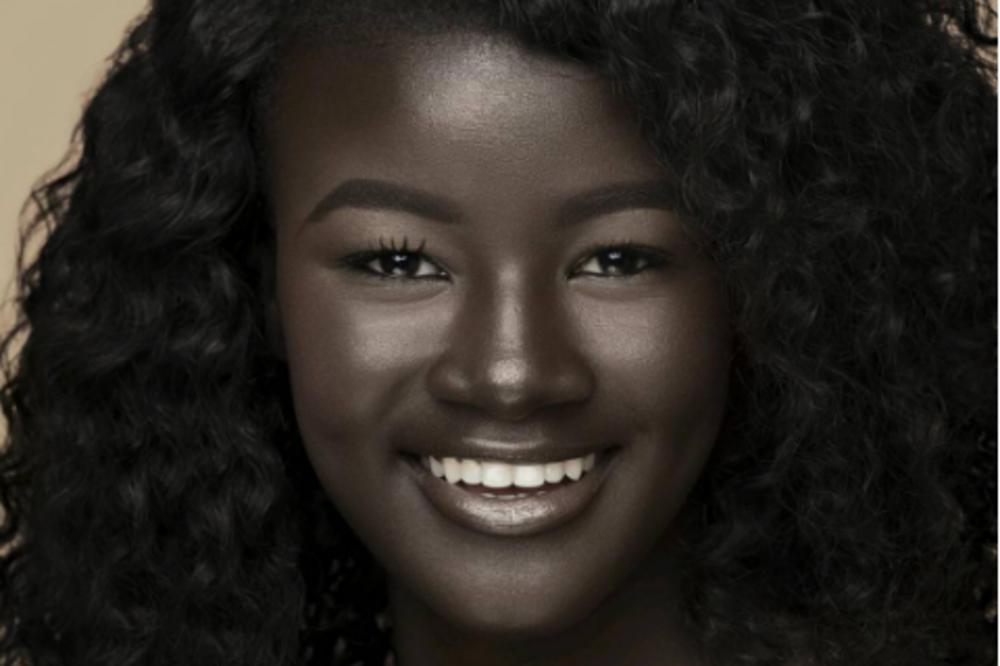 Maltretirali su je zbog boje kože, govorili joj da je ružna a sada se bavi modelingom i izgleda OVAKO! (FOTO) (VIDEO)