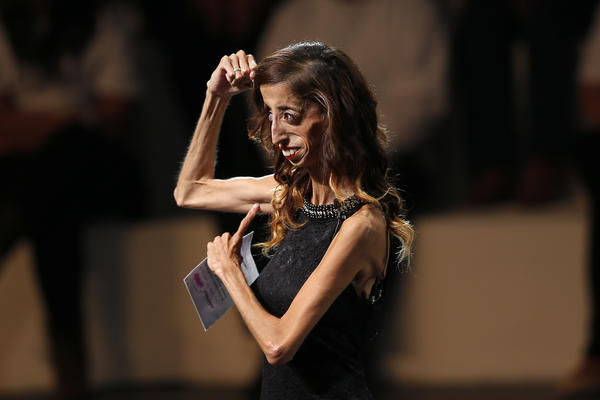 Ona je NAJRUŽNIJA žena na svetu, ali je NAJLEPŠI primer za mlade devojke! (FOTO) (VIDEO)