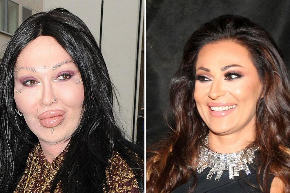 CECA RAŽNATOVIĆ JE IMALA DVOJNIKA! Posle 300 operacija, srce mu NIJE IZDRŽALO