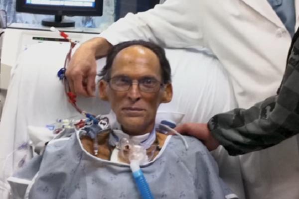 Čovek BEZ SRCA, ali stvarno! Ovo je jedina osoba na planeti koja živi BEZ PULSA! (VIDEO)