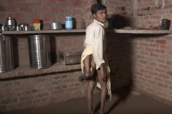 On ima 4 noge i svi mu se smeju zbog toga: UŽASNA ISPOVEST ovog dečaka nateraće vas da zaplačete! (VIDEO)