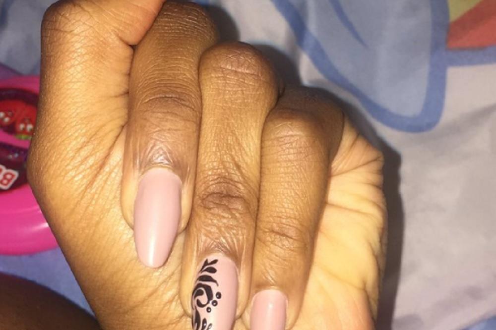 Okačila je ovu sliku, ali NIKO nije mogao da provali o čemu se radi! Njen odgovor će vas NAJEŽITI! (FOTO)