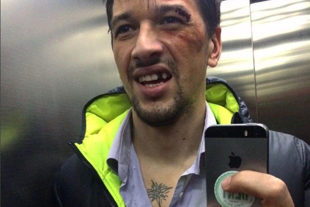 UNAKAZILI GA: Ko je OVAKO prebio Viktora Savića!? (FOTO)