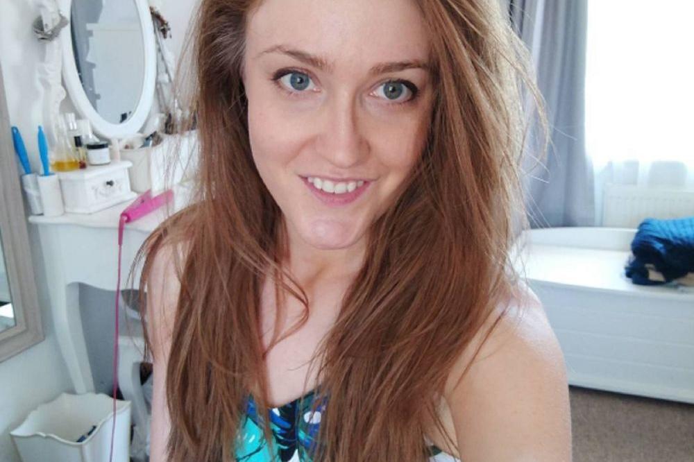 Nije prala kosu šamponom dve godine. Rezultat je zapanjujuć! (FOTO)