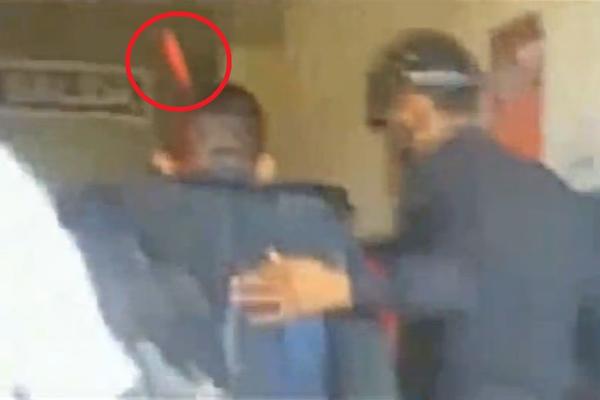 Čovek šeta, a NOŽ MU U LOBANJI! Jeziviju stvar niste skoro videli! (VIDEO)