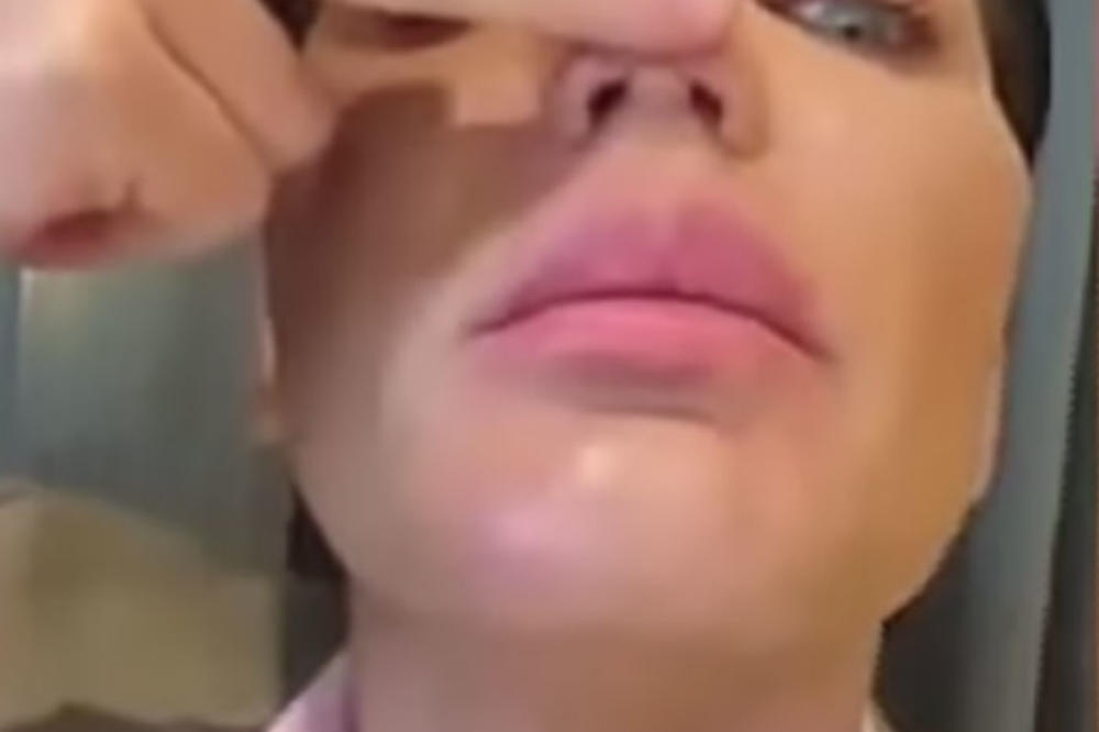 DOK SE UMIVALA OSETILA JE UŽASNU BOL U NOSU: Uradila je BIOPSIJU, a kad su joj stigli REZULTATI UKOPALA SE U MESTU