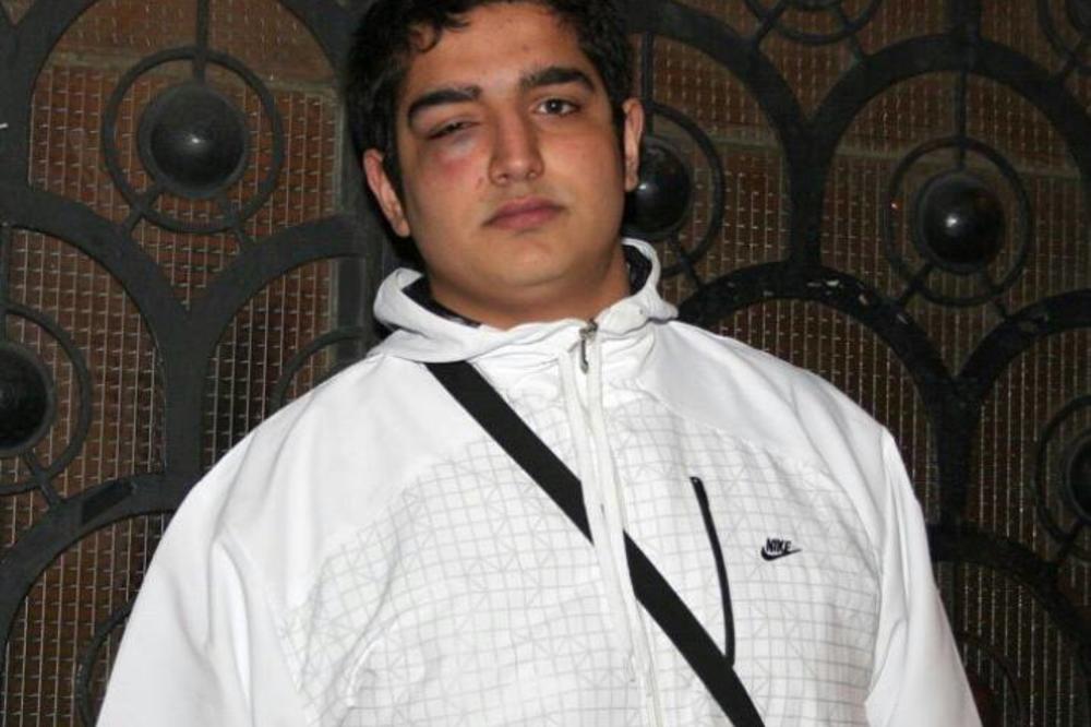 ZVERSKI PRETUČEN ROM SAMO ZATO ŠTO JE ROM: Vikali su mi MARŠ ODAVDE CIGANŠTURO JEDNA! ! (FOTO)!