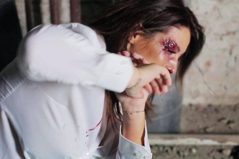 PRETUČENA Seka Aleksić!!! NE GLEDAJTE AKO IMATE SLAB STOMAK!! (18+) (FOTO)