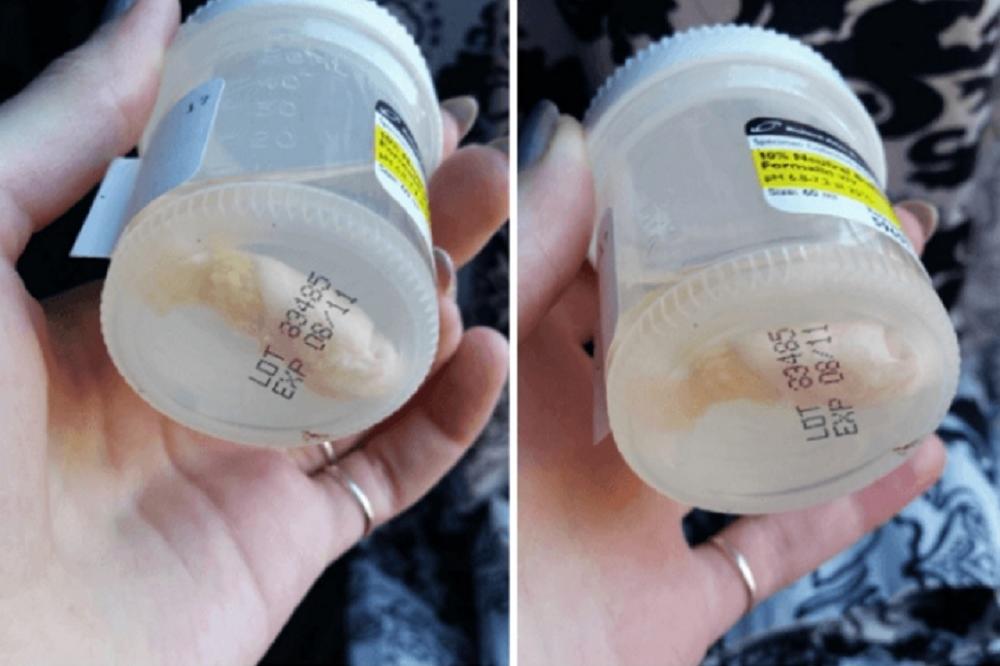 Poslala je vereniku svoj MALI NOŽNI PRST i rekla mu je da ga pretvori u OGRLICU! (FOTO)