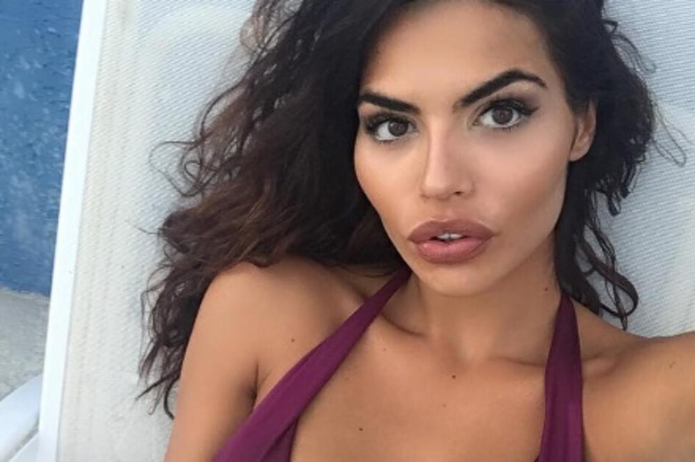 Eto šta PLASTIKA UČINI! Ovo je sestra seksi Dejane, a nemaju nikakve sličnosti zbog operacija manekenke (FOTO)