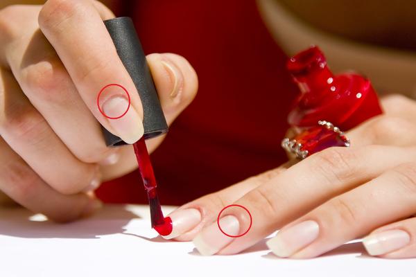 Beli polumesec na noktima GOVORI MNOGO O VAŠEM ZDRAVLJU: Njegov manjak UKAZUJU NA OVE BOLESTI!