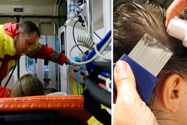 PREMINULA devojčica iz Crne Gore kojoj su roditelji trebili VAŠKE INSEKTICIDIMA!