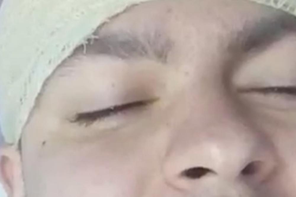 PAZITE SE Operisan Farmer i Zvezda Granda! Tumor mu zauzeo trećinu glave, a izazvalo ga nešto što uzimaju skoro svi mladi tipovi! (FOTO)