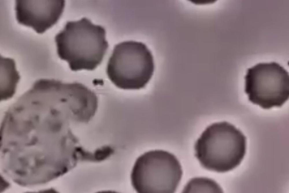 KAKO SE NAŠA KRV BORI SA BOLESTIMA: Neverovatan snimak belih krvnih zranaca koja ubijaju bakteriju! (VIDEO)