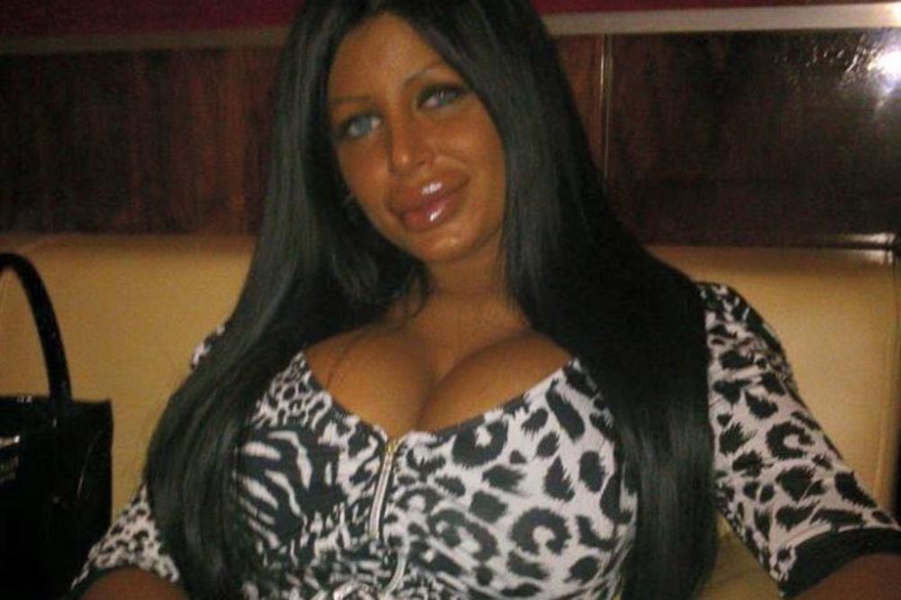 Izduvala se od glave do pete! "Kraljicu silikona" danas niko ne prepoznaje, bila napumpana kao balon, a sad...