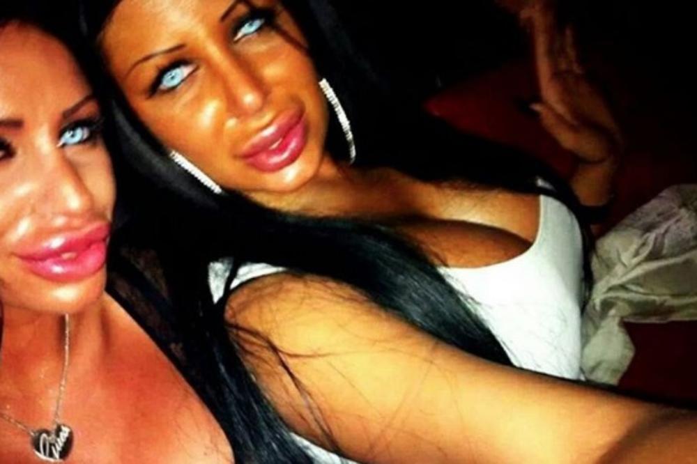 BILE SU SILIKONSKE KRALJICE! Tijana je smanjila grudi i usta, a šta se desilo sa drugom - Sanjom? Ona je tek HIT (FOTO)