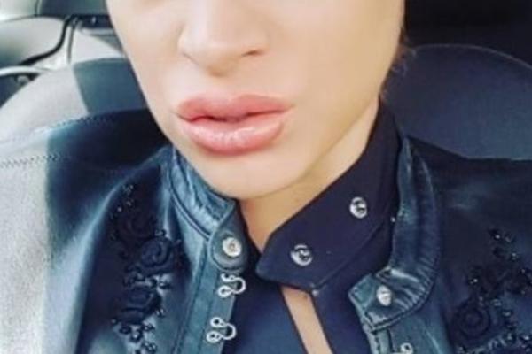 Šta se to dešava sa njom???Poznata PEVAČICA PREREZALA VENE?! (FOTO)