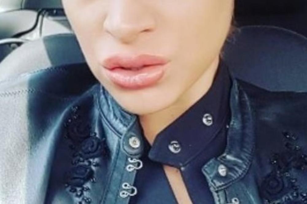 Šta se to dešava sa njom???Poznata PEVAČICA PREREZALA VENE?! (FOTO)