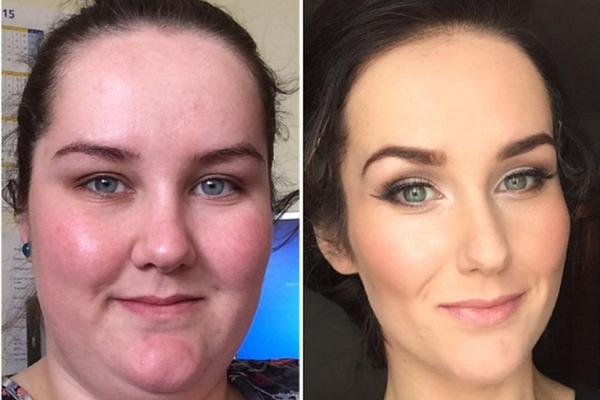 Buduća mlada PREPOLOVILA KILAŽU da bi izgledala dobro na svadbenim FOTOGRAFIJAMA! Kako? (FOTO)