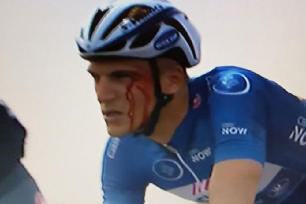 E ovo nismo viđali u biciklizmu: Zabo ga u glavu i pocepao mu arkadu! (VIDEO)