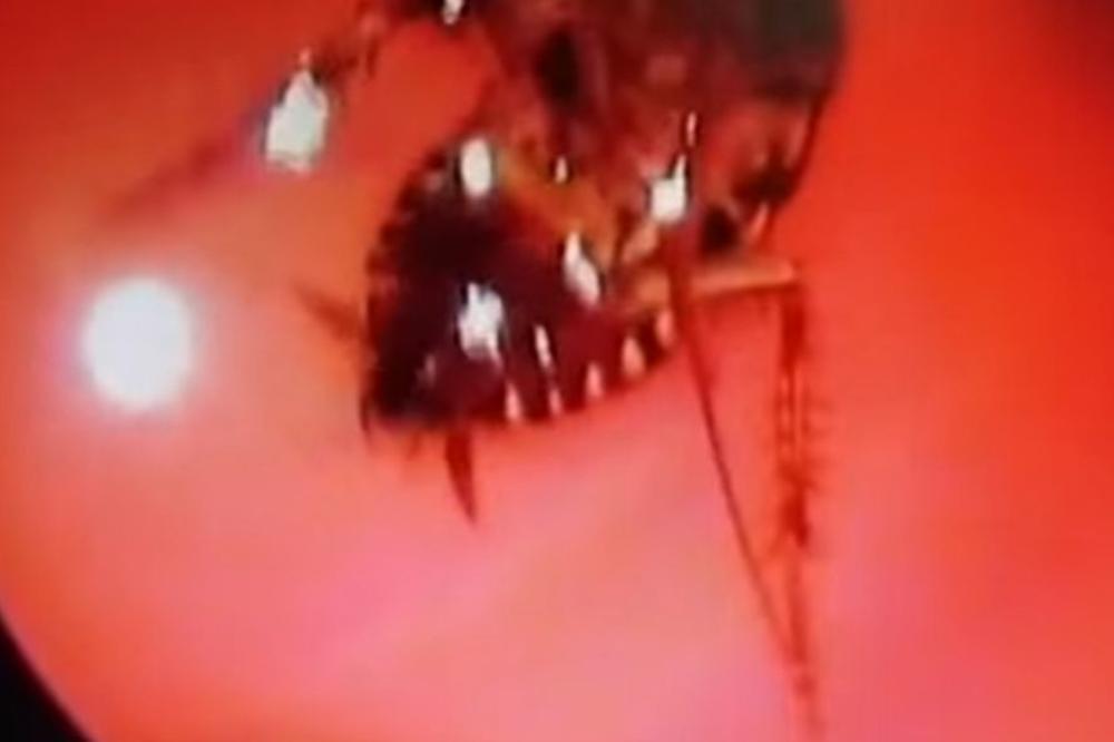 Lekari izvadili ženi živu BUBAŠVABU IZ GLAVE! (VIDEO)