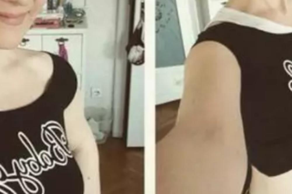 SRPSKA PEVAČICA SE PREPOLOVILA: Smršala do NEPREPOZNATLJIVOSTI! (FOTO)