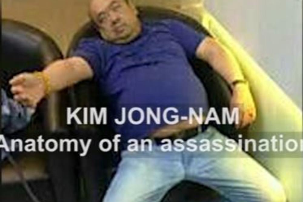 BOLI, MNOGO BOLI. ISPRSKAN SAM TEČNOŠĆU! Procurila poslednja fotografija brata KIM DŽONG - UNA! (VIDEO)