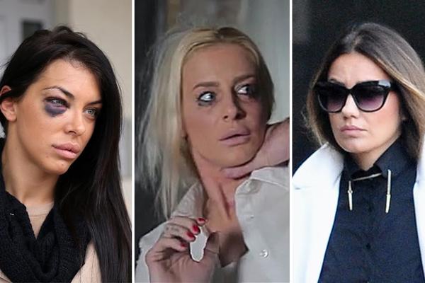 I BOGATI PLAČU: Ove naše zvezde su brutalno pretučene, a jedna je završila tragično! (FOTO)