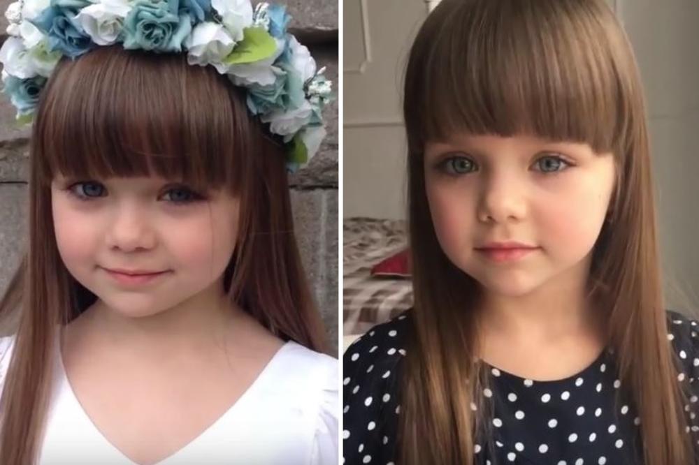 Sećate se najlepše devojčice na svetu? Danas izgleda POTPUNO drugačije! Iznenadićete se! (FOTO)