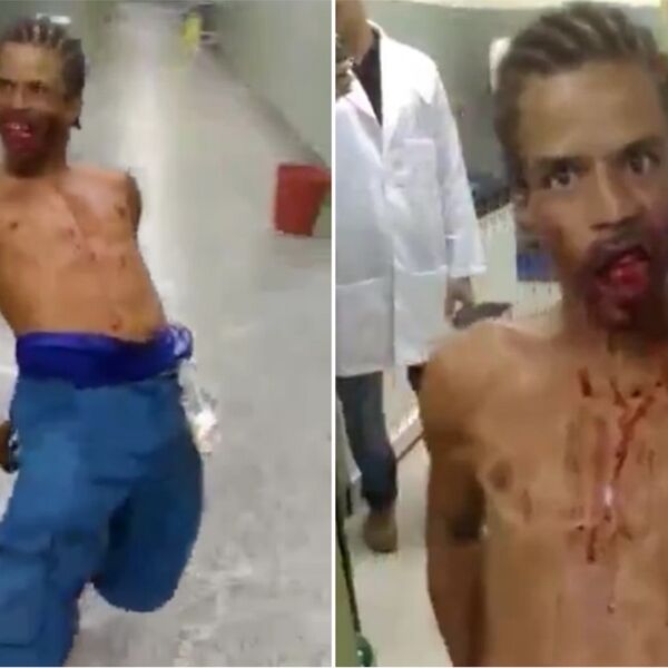 On je dokaz da ZOMBIJI POSTOJE! SA METKOM U FACI paradirao po bolnici kao da ga je ZAPOSEO ĐAVO! (VIDEO)