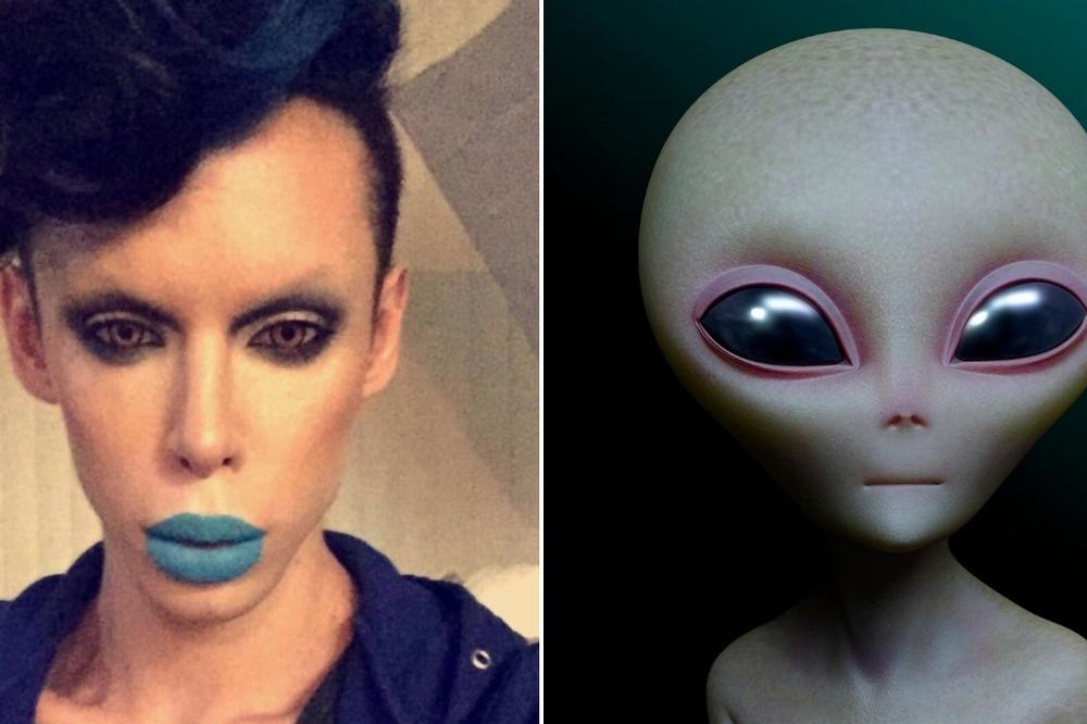 Potrošio je 50.000 dolara da bi ličio na bespolnog vanzemaljca! Faca mu je identična kao kod malih zelenih, a tek telo! (FOTO)