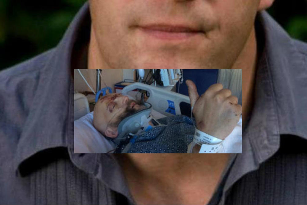 Popularnom glumcu slomljene SVE KOSTI i vrat u užasnoj saobraćajnoj NESREĆI (FOTO)