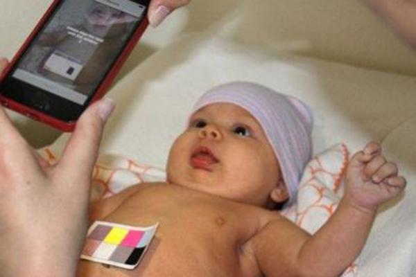 POMOĆU MOBILNOG SAZNAO DA MU JE SIN TEŠKO BOLESTAN Otac otkrio rak na osnovu fotografije (FOTO)