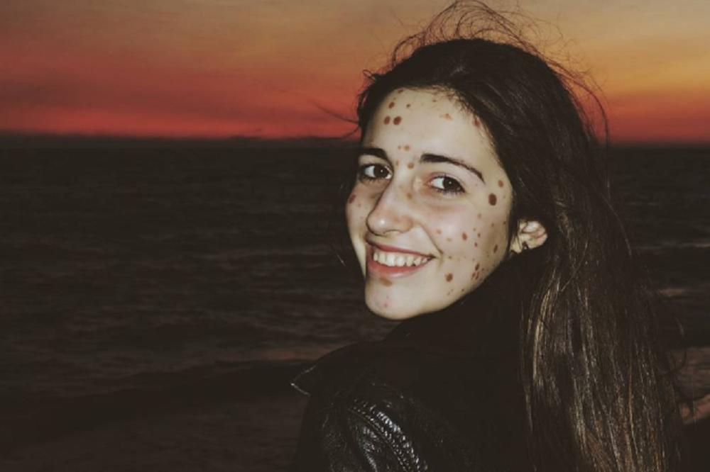 Preživela je pravu torturu: Rođena je sa 500 belega, a sada je na naslovnim stranama! (FOTO)