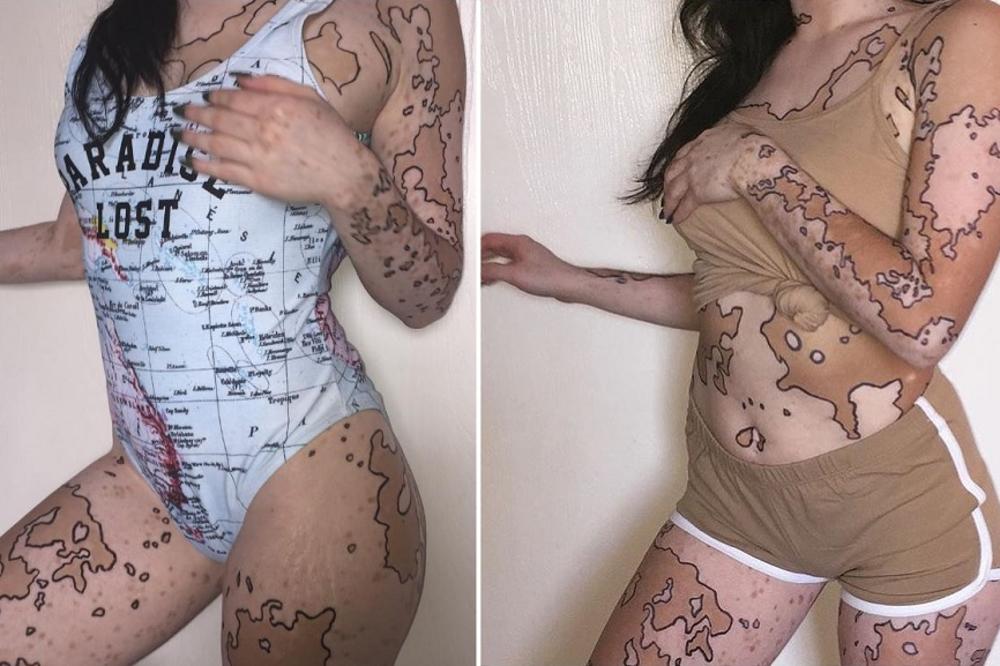 Svi su joj se rugali zbog izgleda, a ona sada razbija svojim telom! (FOTO)