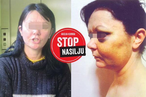 MUŽ MONSTRUM je golu vozio kroz grad! Tukao je sedam sati! (FOTO)