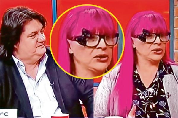 OZBILJNI PROBLEMI SA SILIKONIMA: Zorici se raspadaju usta, pogledajte i SAMI! (FOTO)