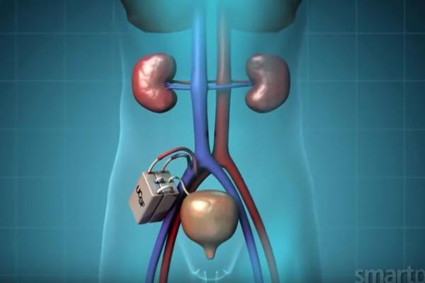 POŽELJNO JE DA BELI LUK BUDE DEO ISHRANE, ALI NEKA OD ČUDA KOJA MU SE PRIPISUJU SU PRETERANA